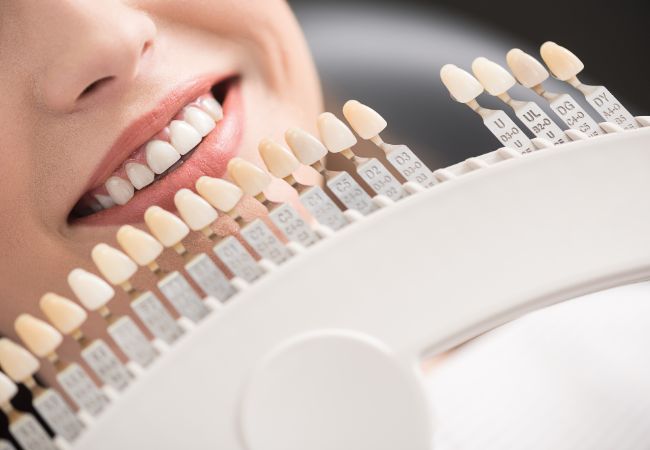 カラーチャート