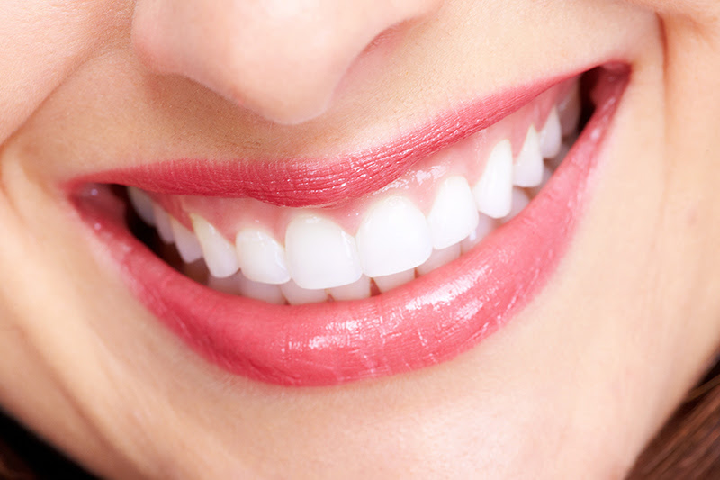 歯の色が気になる方におすすめのホワイトニング